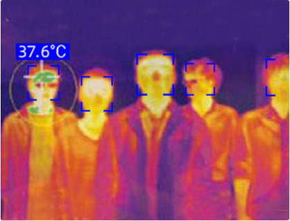 为何新冠病毒、SARS的靶器官总是肺