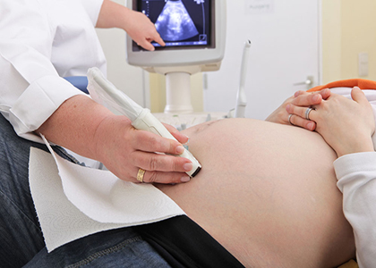 产前超声能查出什么 产检超声能查出胎儿畸形吗