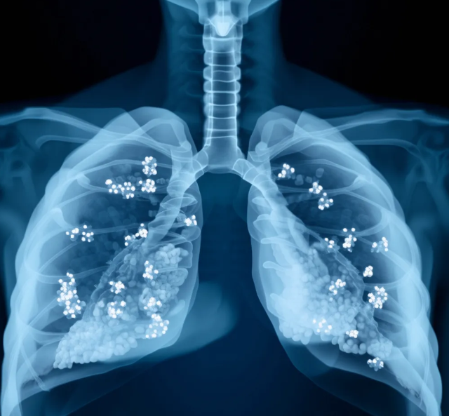 096768ca-525b-4cbc-8df2-1b0e1d28672c.png QQ20250620-162458.png