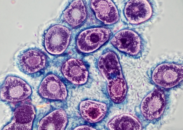 组织活检 组织活检