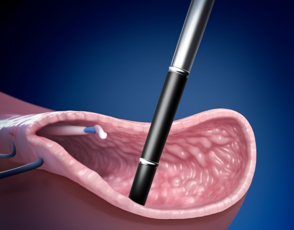 费用影响因素 费用影响因素