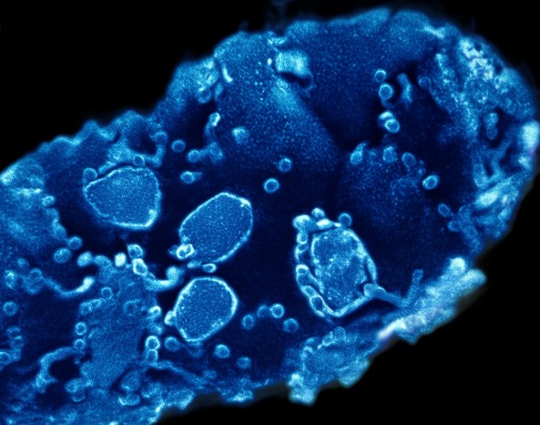 肚子老是不舒服,咕噜响、胀气、隐隐作痛 肚子老是不舒服,咕噜响、胀气、隐隐作痛