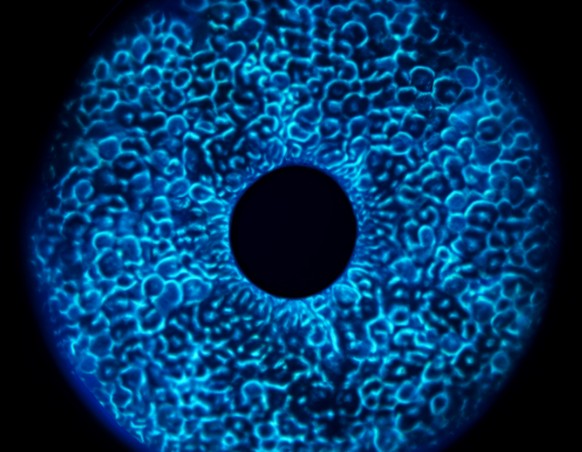 角膜检查是眼科诊断的关键环节