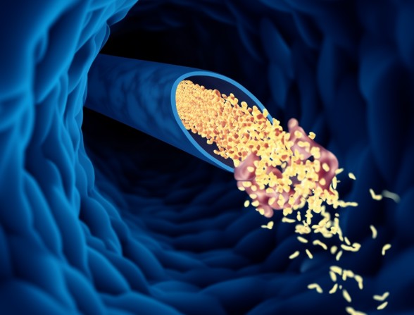动脉硬化检查的禁忌症 动脉硬化检查的禁忌症
