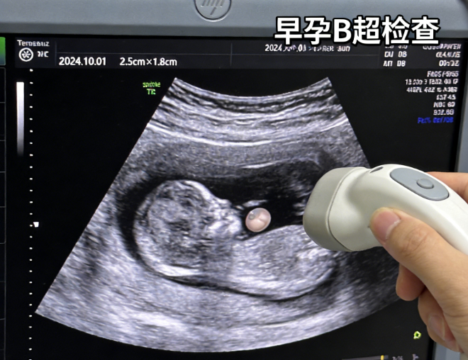 怀孕最关键的五项检查